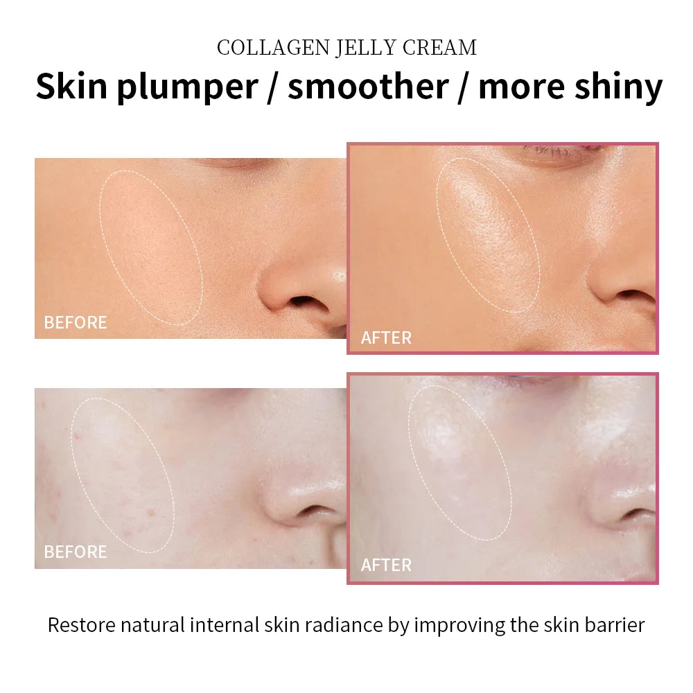 Lakerain Collagen Jelly Cream — Luxury Collagen Glow Moisturizer 100ml